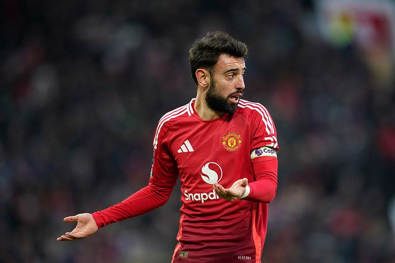 Bruno Fernandes Kena Kartu Merah, Siapa Kapten MU saat Lawan Newcastle?